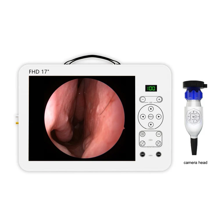 17 Inch HD Video Otoscope ENT  - Medical Lab Images 评论和价格